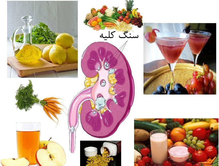 میوههایی برای از بین بردن سنگ کلیه