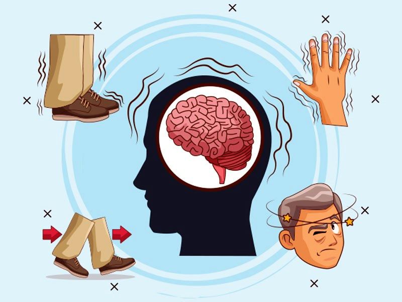 علائم پارکینسون در مردان و زنان چه تفاوتی دارد؟