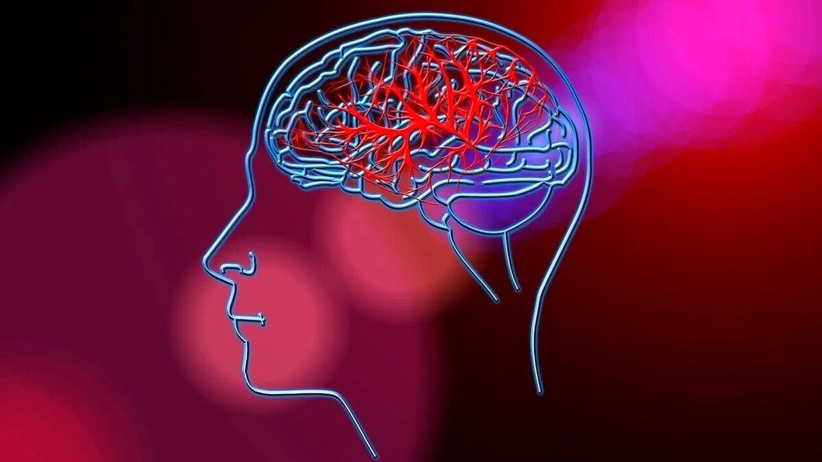 پیشگیری از ۸۰ درصد سکتههای مغزی با چند توصیه بهداشتی